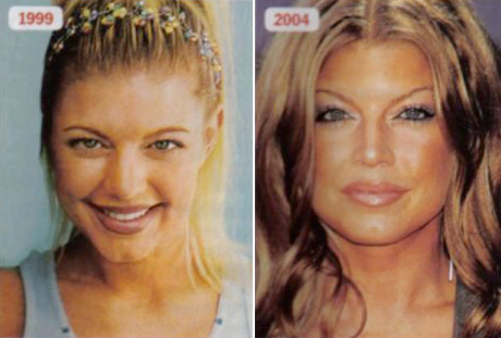 fergie ugly face